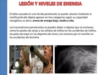 El daño causado en una herida penetrante se puede calcular mediante la
clasificación del objeto agresor en tres categorías según su capacidad
energética, es decir, armas de energía baja, media o alta.
Los traumatismos penetrantes se pueden deber a objetos que se enclavan,
como los postes de verjas y las señales de tráfico en los accidentes de tráfico,
los palos de esquí en los deportes de nieve y las lesiones por el manillar en
los accidentes de bicicleta.

 