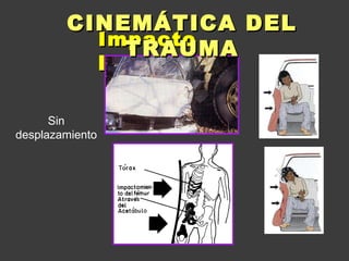 Cinematica del trauma u2 | PPT