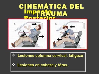 Cinematica del trauma u2 | PPT