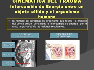 Cinematica del trauma u2 | PPT