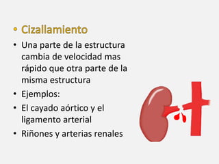 • Una parte de la estructura
cambia de velocidad mas
rápido que otra parte de la
misma estructura
• Ejemplos:
• El cayado aórtico y el
ligamento arterial
• Riñones y arterias renales
 