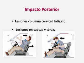 • Lesiones columna cervical, latigazo
• Lesiones en cabeza y tórax.
 