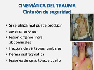C
• Si se utiliza mal puede producir
• severas lesiones.
• lesión órganos intra
abdominales
• fractura de vértebras lumbares
• hernia diafragmática
• lesiones de cara, tórax y cuello
 