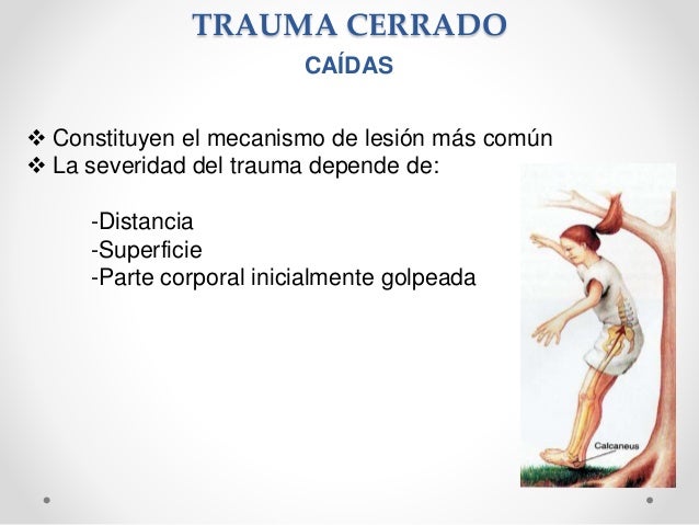 Trujillo 2016, Cinematica del Trauma