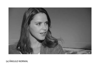 (a) ÂNGULO NORMAL
 