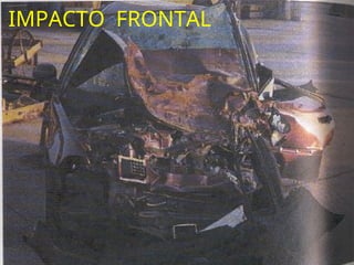 IMPACTO FRONTAL
 
