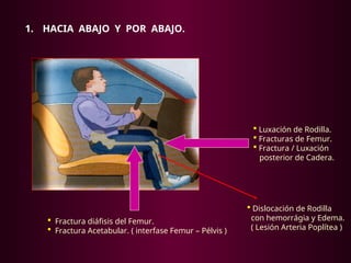 1. HACIA ABAJO Y POR ABAJO.
 Luxación de Rodilla.
 Fracturas de Femur.
 Fractura / Luxación
posterior de Cadera.
 Fractura diáfisis del Femur.
 Fractura Acetabular. ( interfase Femur – Pélvis )
 Dislocación de Rodilla
con hemorrágia y Edema.
( Lesión Arteria Poplítea )
 