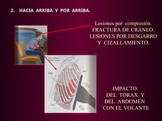2. HACIA ARRIBA Y POR ARRIBA.
IMPACTO
DEL TORAX Y
DEL ABDOMEN
CON EL VOLANTE
Lesiones por compresión.
FRACTURA DE CRÁNEO.
LESIONES POR DESGARRO
Y CIZALLAMIENTO.
 