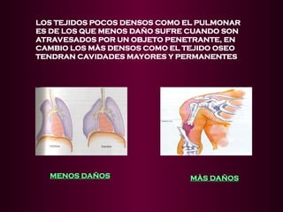 LOS TEJIDOS POCOS DENSOS COMO EL PULMONAR
ES DE LOS QUE MENOS DAÑO SUFRE CUANDO SON
ATRAVESADOS POR UN OBJETO PENETRANTE, EN
CAMBIO LOS MÀS DENSOS COMO EL TEJIDO OSEO
TENDRAN CAVIDADES MAYORES Y PERMANENTES
MÀS DAÑOS
MÀS DAÑOS
MENOS DAÑOS
MENOS DAÑOS
 