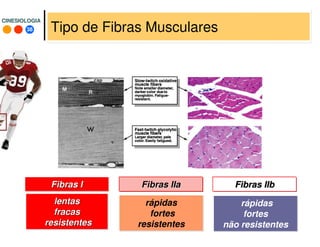 38
CINESIOLOGIACINESIOLOGIA
Tipo de Fibras Musculares
lentaslentas
fracasfracas
resistentesresistentes
rápidas
fortes
não resistentes
Fibras IFibras I FibrasFibras IIbIIbFibrasFibras IIaIIa
rápidas
fortes
resistentes
 