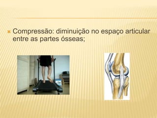    Compressão: diminuição no espaço articular
    entre as partes ósseas;
 