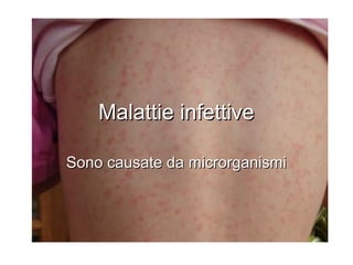 Malattie infettiveMalattie infettive
Sono causate da microrganismiSono causate da microrganismi
 