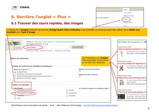 CINAHL
32
Bibliothèque interuniversitaire de Santé – Paris – pôle Médecine-Odontologie – formation@biusante.parisdescartes.fr
6. Derrière l’onglet « Plus »
6.1 Trouver des cours rapides, des images
La recherche d’images illustrant les articles (Image Quick View Collection ) est possible, la recherche peut être affiner dans Ciblez vos
résultats puis Type d’image.
Les illustrations ou images
sont proposées directement
sur la liste des résultats.
 