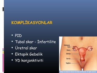KOMPLİKASYONLAR


 PID
 Tubal skar - İnfertilite
 Üretral skar
 Ektopik Gebelik
 YD konjonktiviti
 