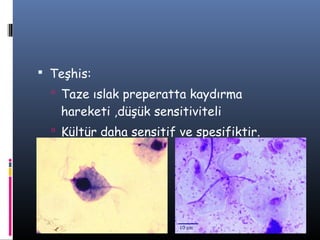  Teşhis:
   Taze ıslak preperatta kaydırma
   hareketi ,düşük sensitiviteli
   Kültür daha sensitif ve spesifiktir.
 