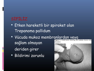 SİFİLİZ
 Etken hareketli bir spiroket olan
  Trepanoma pallidum
 Vücuda mukoz membranlardan veya
  sağlam olmayan
  deriden girer
 Bildirimi zorunlu
 