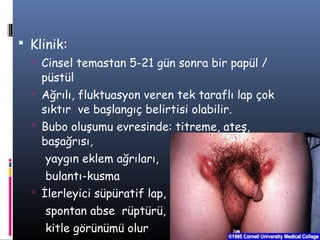  Klinik:
   Cinsel temastan 5-21 gün sonra bir papül /
    püstül
   Ağrılı, fluktuasyon veren tek taraflı lap çok
    sıktır ve başlangıç belirtisi olabilir.
   Bubo oluşumu evresinde: titreme, ateş,
    başağrısı,
    yaygın eklem ağrıları,
    bulantı-kusma
   İlerleyici süpüratif lap,
    spontan abse rüptürü,
    kitle görünümü olur
 