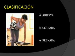 CLASIFICACIÓN
 ABIERTA
 CERRADA
 FRENADA
 