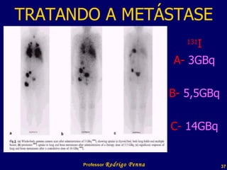 TRATANDO A METÁSTASE 131 I A-  3GBq B-  5,5GBq C-  14GBq Professor  Rodrigo Penna  www.fisicanovestibular.com.br   