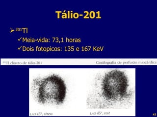 Tálio-201 201 Tl Meia-vida: 73,1 horas Dois fotopicos: 135 e 167 KeV Professor  Rodrigo Penna 