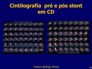 Cintilografia  pré e pós stent em CD Professor  Rodrigo Penna  www.fisicanovestibular.com.br   