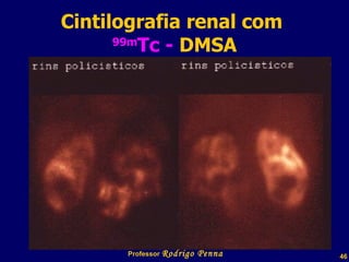 Cintilografia renal com  99m Tc -  DMSA Professor  Rodrigo Penna 