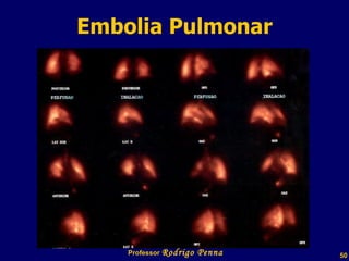 Embolia Pulmonar Professor  Rodrigo Penna  www.fisicanovestibular.com.br   