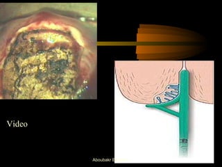 Video 
Aboubakr Elnashar 
 
