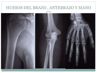 HUESOS DEL BRAZO , ANTEBRAZO Y MANO
 