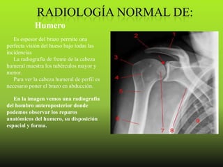 Humero
   Es espesor del brazo permite una
perfecta visión del hueso bajo todas las
incidencias
   La radiografía de frente de la cabeza
humeral muestra los tubérculos mayor y
menor.
   Para ver la cabeza humeral de perfil es
necesario poner el brazo en abducción.

   En la imagen vemos una radiografia
del hombro anteroposterior donde
podemos observar los reparos
anatómicos del humero, su disposición
espacial y forma.
 