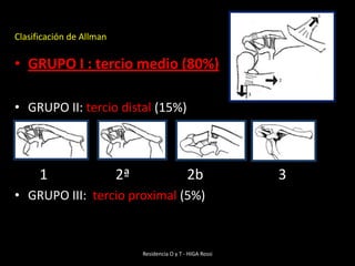 Caídas sobre el hombro (87%) Impactos directos (7%) Caídas sobre la mano (6%)Residencia O y T - HIGA RossiMECANISMO 