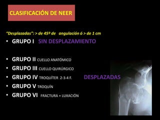 POCO DESPLAZAMIENTO