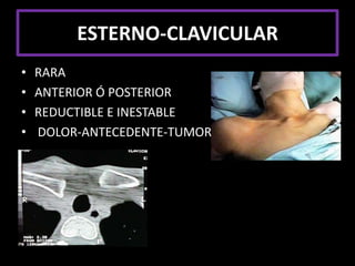 DIAGNÓSTICOCLÍNICOMECANISMODIRECTO