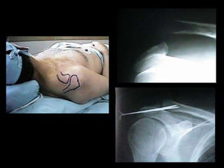 DOLOR