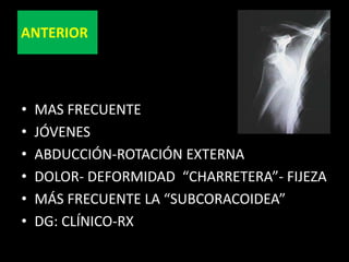 IMPOTENCIA