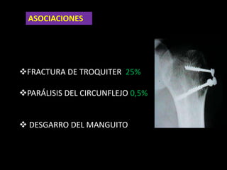 HEMATOMA DE HENNEKIN