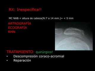 ARTRITISACROMIO-CLAVICULAR