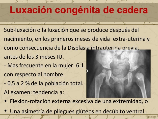 Si ha tomado la columna vertebral el departamento de pecho