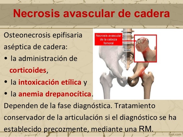 El complejo de los ejercicios para la profiláctica del dolor en la espalda