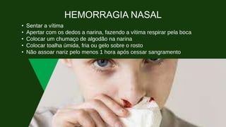 HEMORRAGIA NASAL
• Sentar a vítima
• Apertar com os dedos a narina, fazendo a vítima respirar pela boca
• Colocar um chumaço de algodão na narina
• Colocar toalha úmida, fria ou gelo sobre o rosto
• Não assoar nariz pelo menos 1 hora após cessar sangramento
 