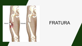FRATURA
 