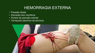 HEMORRAGIA EXTERNA
• Pressão direta
• Elevação dos membros
• Pontos de pressão arterial
• Torniquete (domínio da técnica)
 