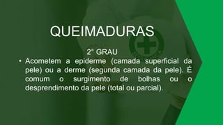 QUEIMADURAS
2° GRAU
• Acometem a epiderme (camada superficial da
pele) ou a derme (segunda camada da pele). É
comum o surgimento de bolhas ou o
desprendimento da pele (total ou parcial).
 