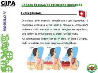 CIPACIPAEditora Gráficos Burti Ltda.Editora Gráficos Burti Ltda.
Unida ItaquaquecetubaUnida Itaquaquecetuba
GESTÃOGESTÃO
2012/20132012/2013
QUEIMADURAS
O contato com chamas, substâncias super-aquecidas, a
exposição excessiva à luz solar e mesmo à temperatura
ambiente muito elevada, provocam reações no organismo,
que podem se limitar à pele ou afetar funções vitais.
As queimaduras podem ser de 1º grau, 2º grau e 3º grau,
cada uma delas com suas próprias características.
NOÇÕES BÁSICAS DE PRIMEIROS SOCORROSMÓDULOVMÓDULOV
 