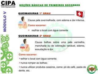 CIPACIPAEditora Gráficos Burti Ltda.Editora Gráficos Burti Ltda.
Unida ItaquaquecetubaUnida Itaquaquecetuba
GESTÃOGESTÃO
2012/20132012/2013
QUEIMADURAS 1º GRAU
Causa pele avermelhada, com edema e dor intensa.
Como socorrer:
 resfriar o local com água corrente
QUEIMADURAS 2º GRAU
Causa bolhas sobre uma pele vermelha,
manchada ou de coloração variável, edema,
exsudação e dor.
Como socorrer:
esfriar o local com água corrente;
nunca romper as bolhas;
nunca utilizar produtos caseiros, como: pó de café, pasta de
dente, etc.
NOÇÕES BÁSICAS DE PRIMEIROS SOCORROSMÓDULOVMÓDULOV
 