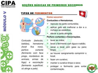 CIPACIPAEditora Gráficos Burti Ltda.Editora Gráficos Burti Ltda.
Unida ItaquaquecetubaUnida Itaquaquecetuba
GESTÃOGESTÃO
2012/20132012/2013
TIPOS DE FERIMENTOS
Contusão (beliscão,
batidas), hematoma
(local fica roxo),
perfuro cortante
(ferimento com faca
prego, mordedura de
animais, armas de
fogo) e escoriação
(ferimento superficial,
só atinge a pele).
Como socorrer:
Contusões e Hematomas.
 repouso da parte contundida;
 aplicar gelo até melhorar a dor e o
inchaço se estabilize;
 elevar a parte atingida.
Perfuro cortantes e Escoriações.
 lavar as mãos;
 lavar o ferimento com água e sabão;
 secar o local com gase ou pano
limpo;
 se houver sangramento comprimir o
local;
 fazer um curativo;
 manter o curativo limpo e seco;
 proteger o ferimento para evitar
contaminação.
NOÇÕES BÁSICAS DE PRIMEIROS SOCORROSMÓDULOVMÓDULOV
 