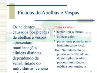 74
Picadas de Abelhas e Vespas
Os acidentes
causados por picadas
de abelhas e vespas,
apresentam
manifestações
clínicas distintas,
dependendo da
sensibilidade do
indivíduo ao veneno
Como socorrer:
 tentar tirar o ferrão;
 colocar gelo;
 passar uma pomada anti-
histamínica no local.
Obs.: No tratamento de
pessoa sensibilizada ou
de múltiplas picadas,
procurar assistência
médica com urgência.
 