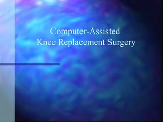 Computer-Assisted 
Knee Replacement Surgery 
 