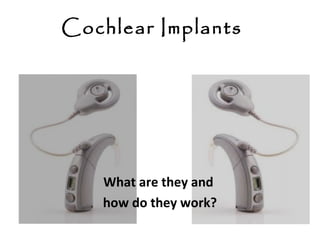 Cochlear Implants

What are they and
how do they work?

 