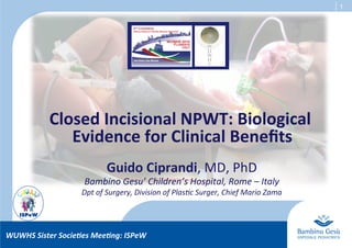 1
Closed	
  Incisional	
  NPWT:	
  Biological	
  
Evidence	
  for	
  Clinical	
  Beneﬁts	
  
Guido	
  Ciprandi,	
  MD,	
  PhD	
  
Bambino	
  Gesu’	
  Children’s	
  Hospital,	
  Rome	
  –	
  Italy	
  
Dpt	
  of	
  Surgery,	
  Division	
  of	
  PlasAc	
  Surger,	
  Chief	
  Mario	
  Zama	
  
WUWHS	
  Sister	
  Socie-es	
  Mee-ng:	
  ISPeW	
  
 